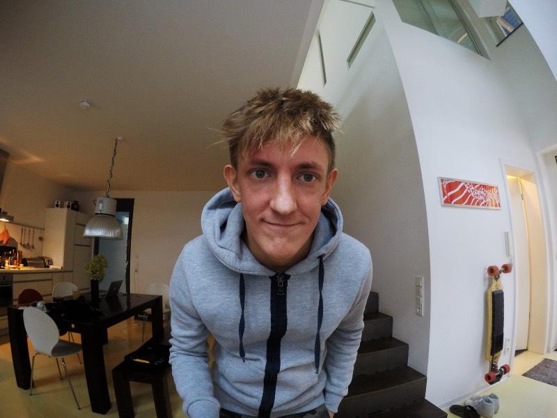 Tipps gegen Neurodermitis